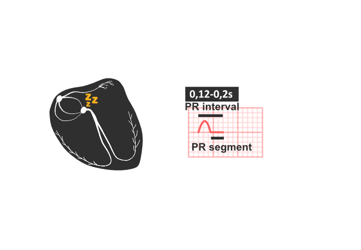 ekg: PR interval, PR segment