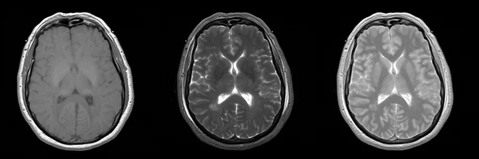 Radiologija: MR